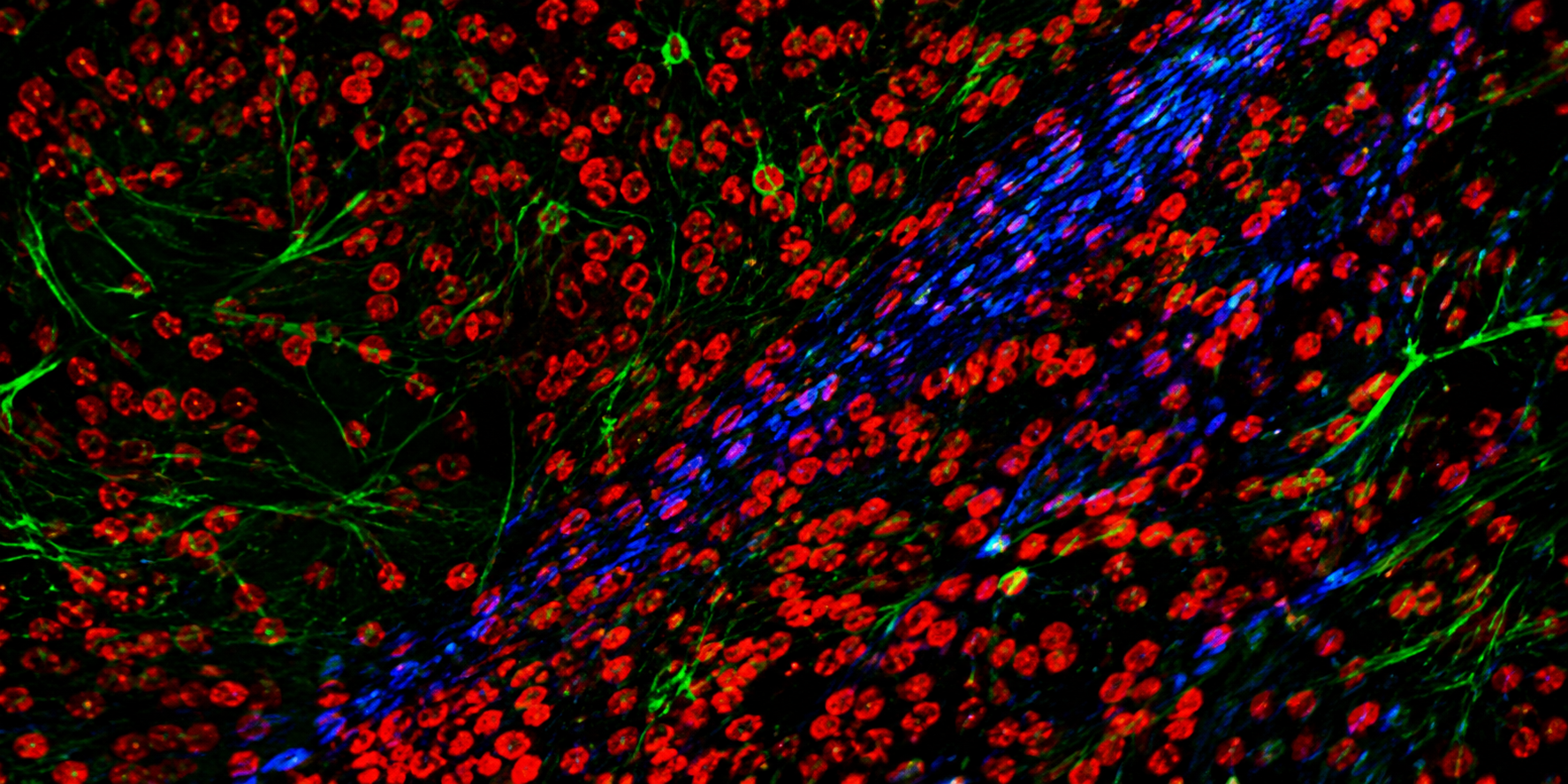 Targeted lipid nanoparticle biological barriers